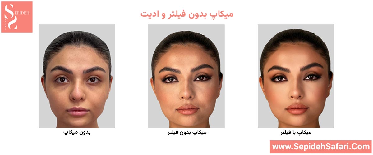 چهره طبیعی قبل از میکاپ بدون فیلتر و ادیت